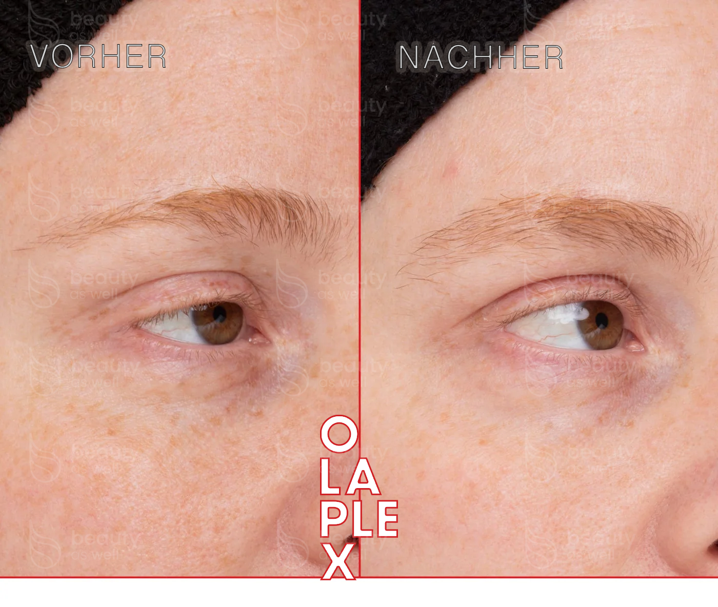 BROWBOND Ergebnisse Vorher-Nachher-Ergebnisse mit OLAPLEX BROWBOND Augenbrauenserum